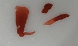 71eb6fa4f61b5789bce045ff6b889bfc 1